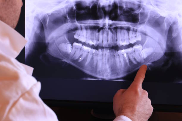 Best Emergency Tooth Extraction in The Plains, OH